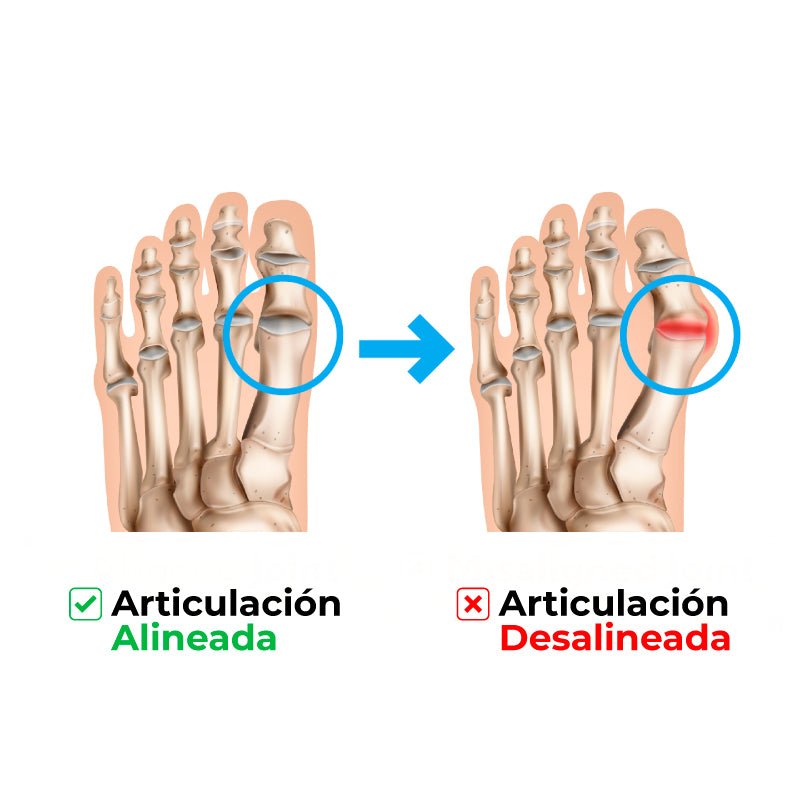 FlexCorrector Pro™️ - SereniVida US